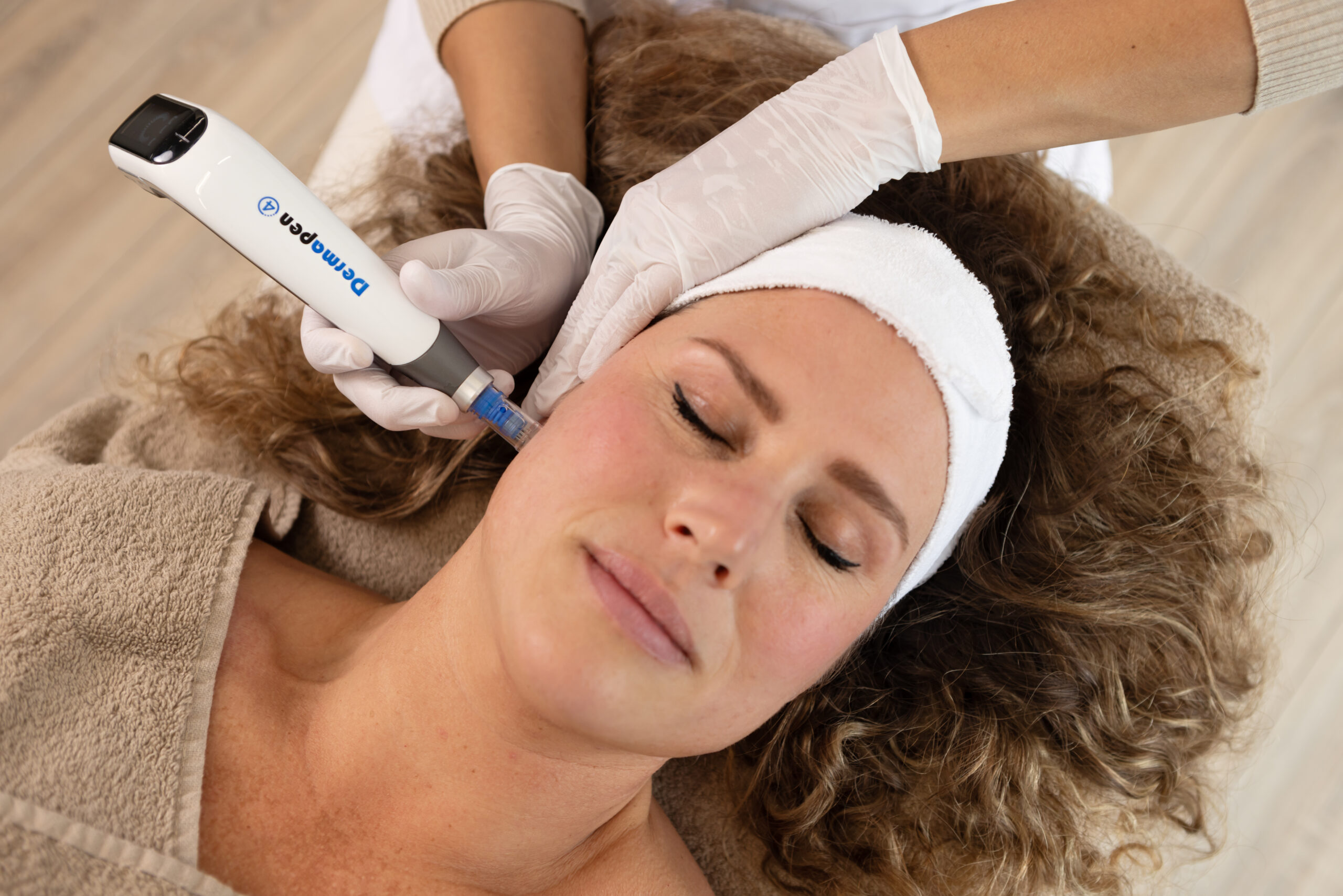 Microneedling met de Dermapen 4
